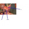 大鼠胆管胆总管插管视频部分视频图片