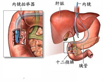 关于大鼠胆管插管的问题